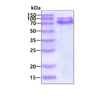 SDS-PAGE Recombinant Human pan Cadherin His Protein